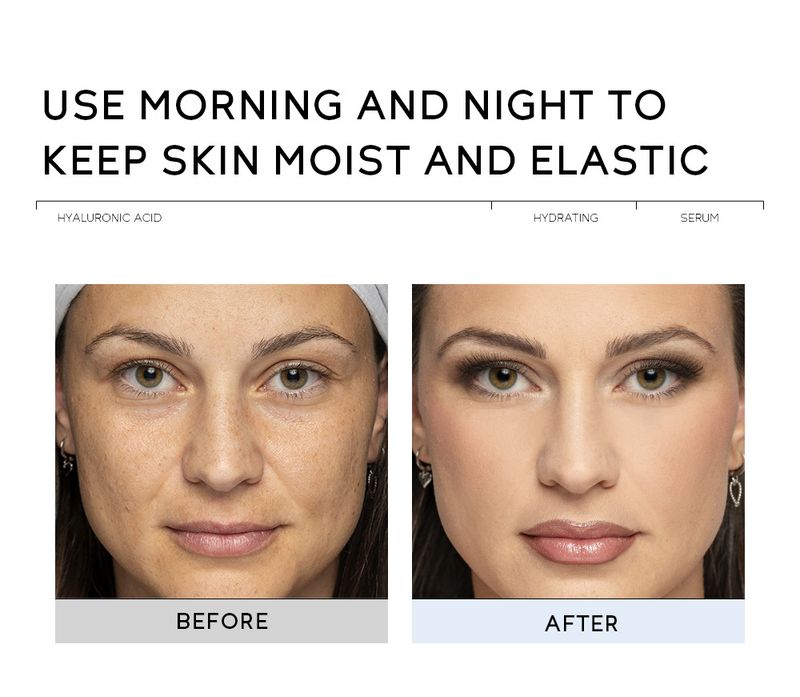 Serum QUIYUM Hyaluronic Acid Essence Hyaluronic Acid Spray Hydrating Repair Stock Solution 30ml_voghion.com