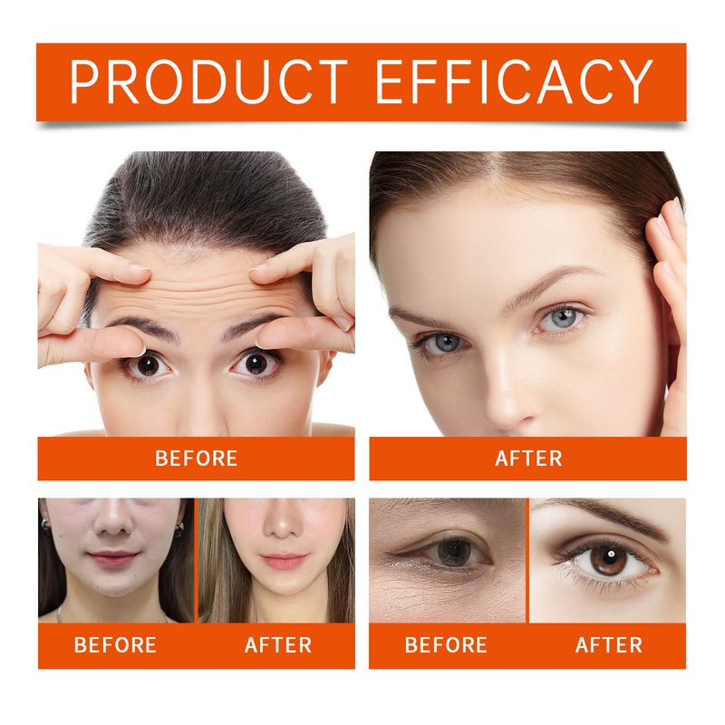 Hoygi Collagen Facial Set Collagen Firming & Nourishing Spray Hydrating & Hydrating Mask_voghion.com