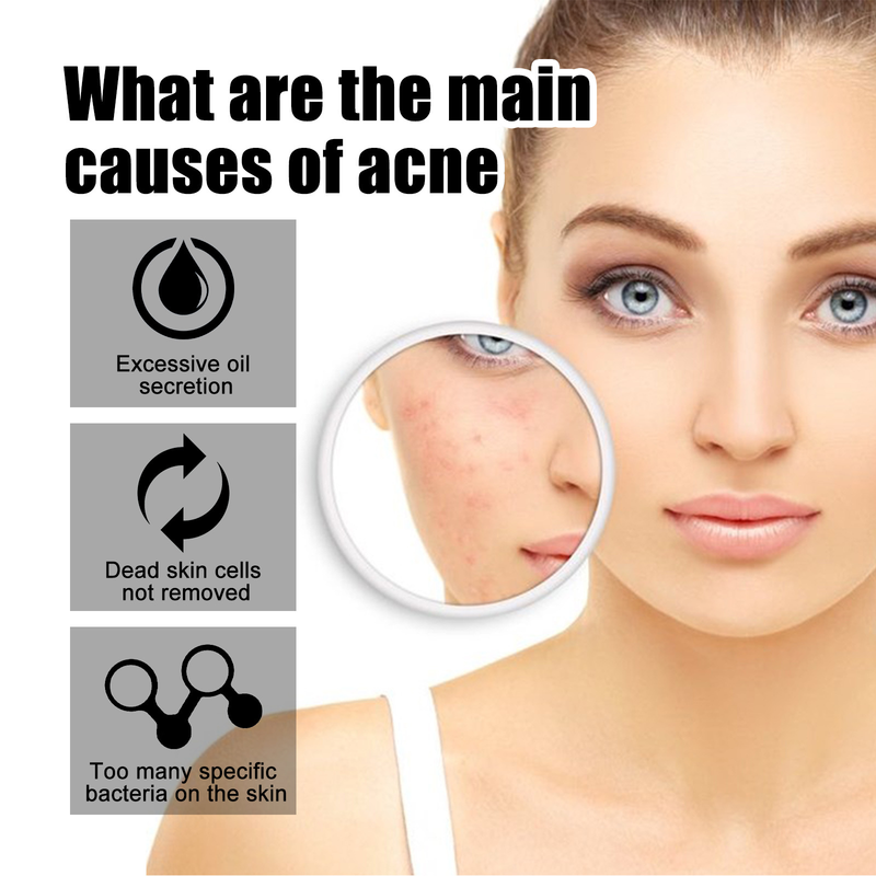 West&Month Colored Patch for Fading Marks and Color Alien Portable Invisible Acne Mask_voghion.com