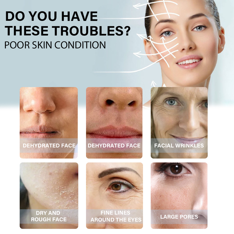 Linea proteica Collagene Assorbibile Lifting Filo Antirughe V-face Lifting Rassodante Schiarente Linee sottili Filler Viso Anti-invecchiamento_voghion.com