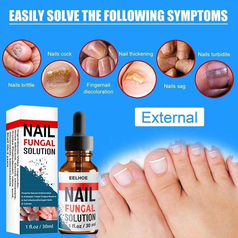 EELHOE 30ml Anti Fungus Liquid Toe Finger Nail Infection Repair Treatment_voghion.com