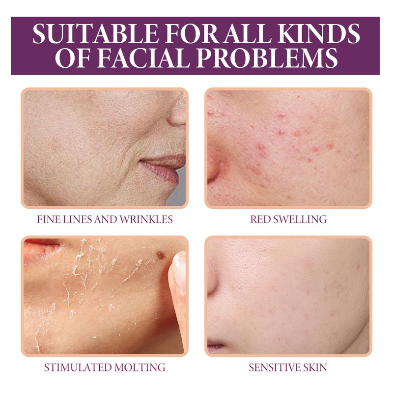 OceanAura Glycolic Acid Repair essence Facial skin barrier repair relieves sensitive muscle smooth, tender and firm_voghion.com