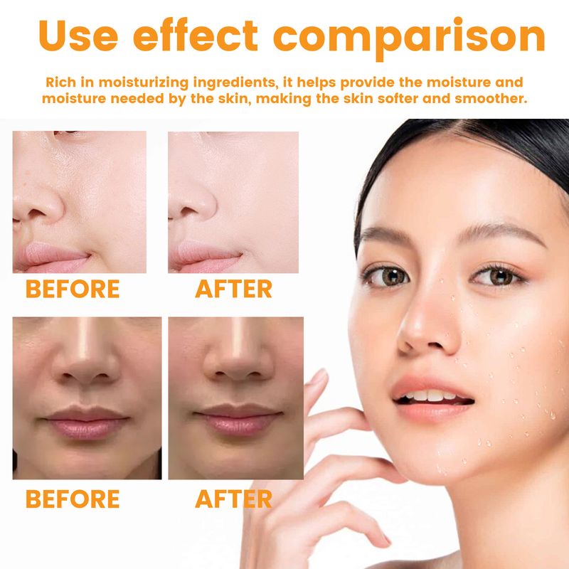 EELHOE Nasolabial Folds Patch, Fading Fine Linjer, Lovlige Linjer, Løfter og Strammer Ansigtshuden Fugtgivende og Hydrerende_voghion.com