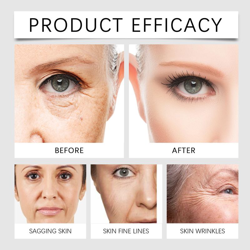 HOYGI Bee Venom Firming Moisturizing Voedt de huid mild, hydrateert en verheldert Dagelijkse huidverzorging Gezichtscrème_voghion.com