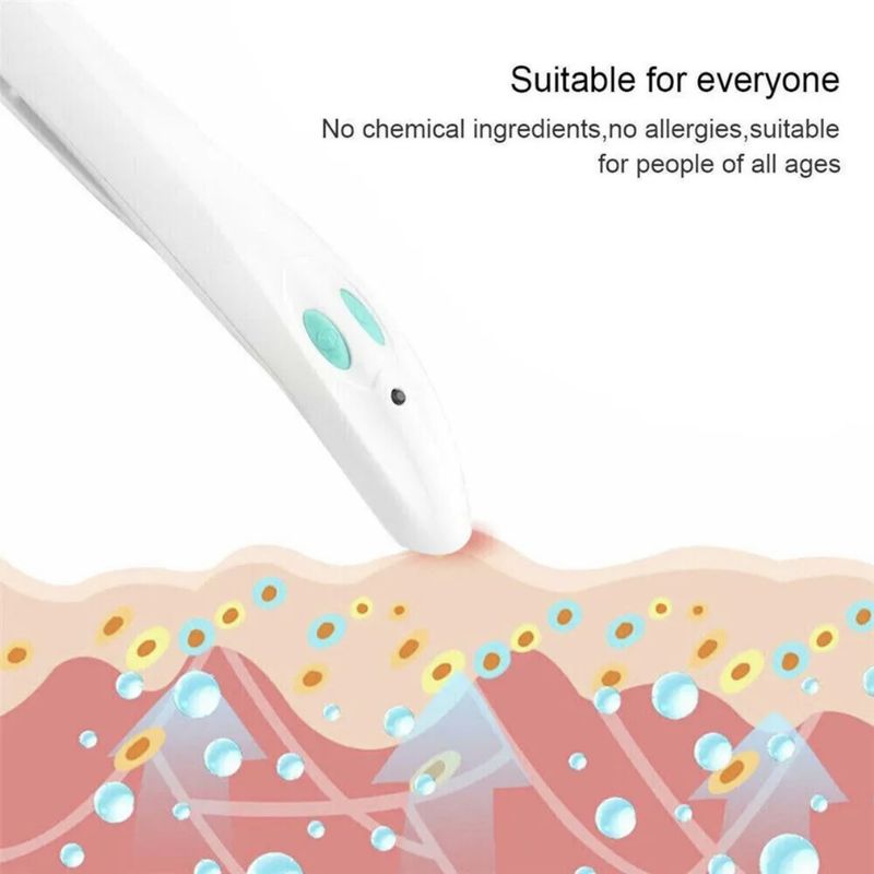 New Portable Physical Pen For Adults And Children Mosquito Bite Relief Device_voghion.com