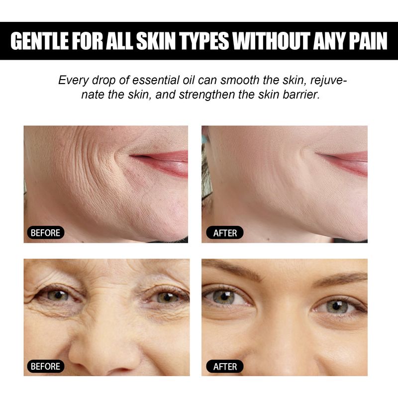EELHOE Facial Instant Tightening Lifting Essential Oil Reduces Wrinkles, Fine Lines, Moisturizes, Tightens, And Smoothes_voghion.com