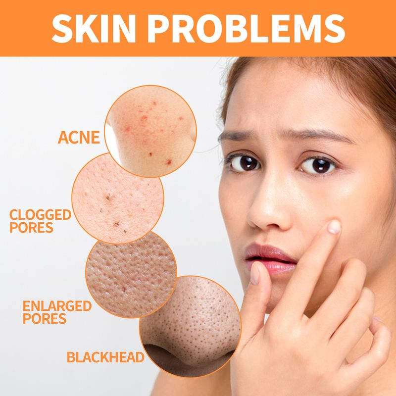 EELHOE Ginger Yellow Mud Stick Mouth Closing, Acne Solid Removing, Facial Mask For Pore Shrinking And Deep Cleaning_voghion.com