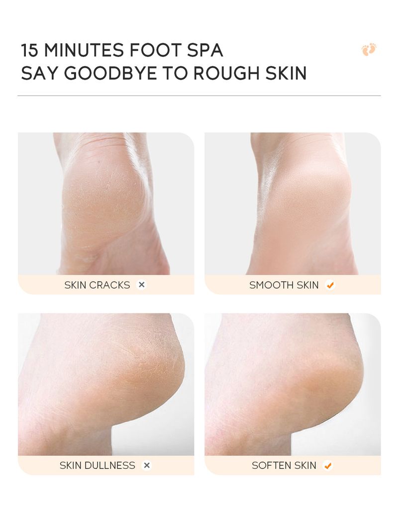 Scrub e trattamenti per il corpo Latte e miele Cera per piedi lacerabile E Cura dei piedi Cheratina_voghion.com