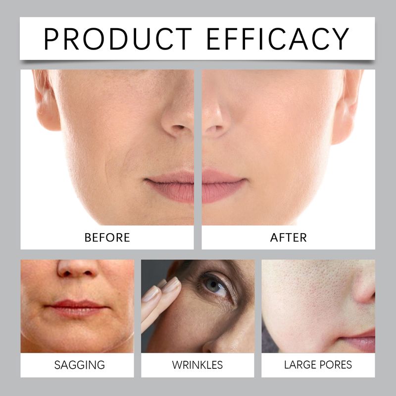 Jaysuing Collagen Mask (Box Set) Gently Cleanses The Skin, Leaving It Refreshing And Non-Greasy, Balancing Oiliness And Purifying Pores_voghion.com