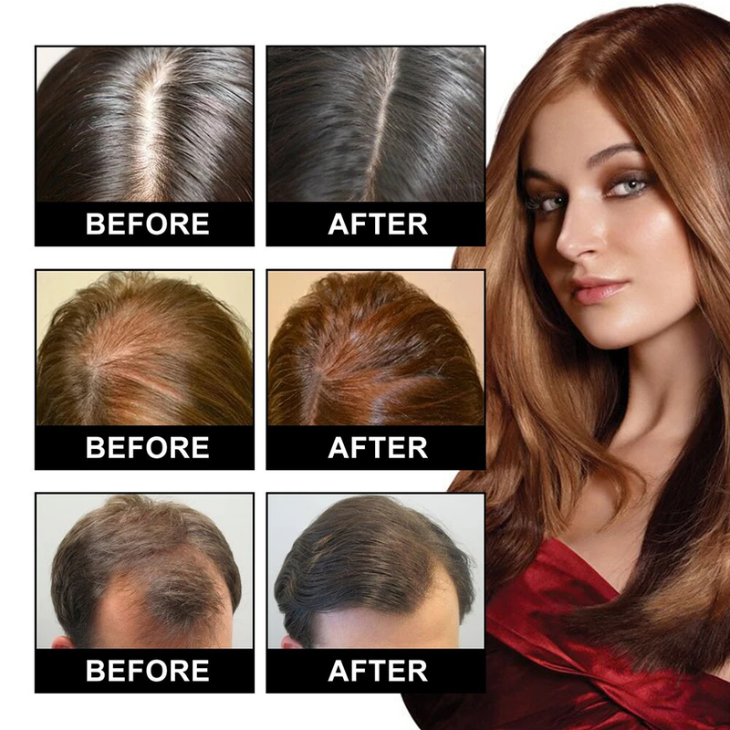 Wachstum 30 ml Ingwer für Männer Frauen Anti-Haarausfall Hydratisiert dichte Reparatur Wurzeln Kopfhautbehandlung Massage Essentials_voghion.com