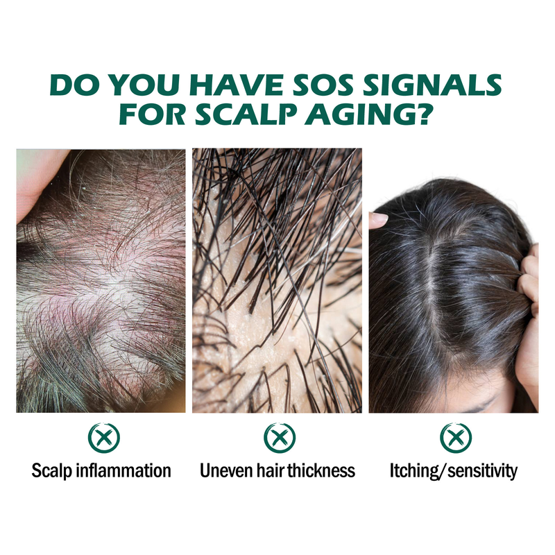 Nettoyage en profondeur du cuir chevelu réparant les racines, soulageant les démangeaisons, prévenant la perte des cheveux denses et fixant les soins capillaires_voghion.com