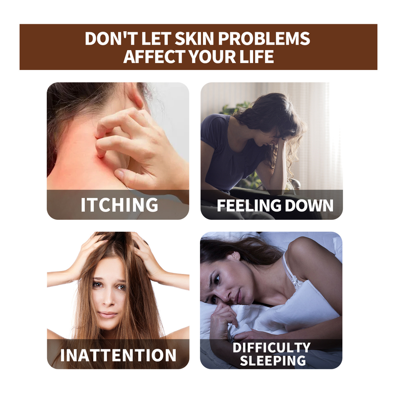 Skin Moss Beautiful Repair Essential Relieve Skin Itch, Stop Itch, Swelling, Hand and Foot Moss External Care Essentia_voghion.com