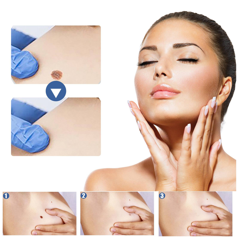 EELHOE Gram Wart Corns Patch, Skin Gram Wart Flesh Mole Black Mole Clean And Care Patch_voghion.com