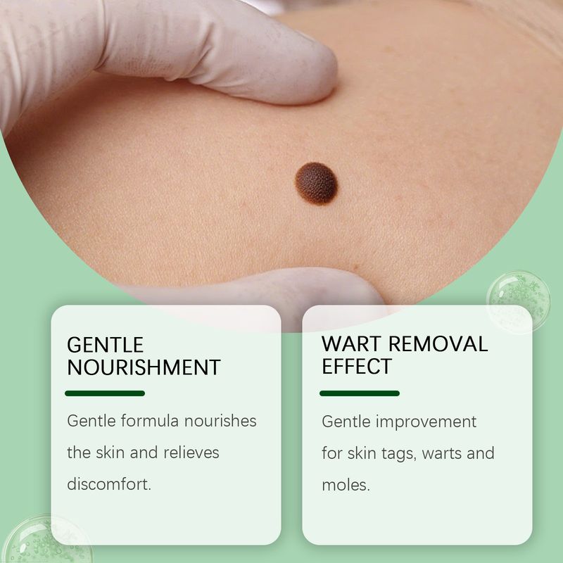 SOUTH MOON Tea Tree Oil Gentle Cleansing Special Nourishing Skin Moisturizing Care Cream_voghion.com