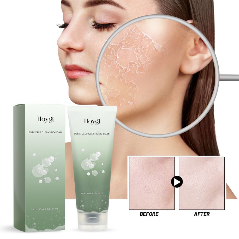 Demachiantul Hoygi Pore Cleansing iluminează pielea feței, curăță în profunzime petele de acnee, curăță, hidratează și hidratează._voghion.com