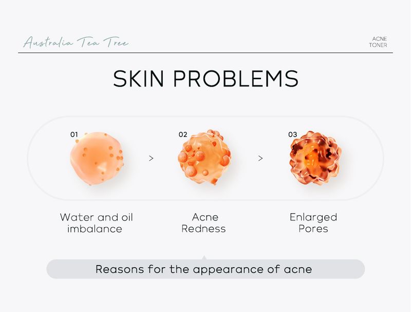 Toners Tea Tree Anti Acne Toner 100ml Hydrating Moisturizing Skin Care Products_voghion.com