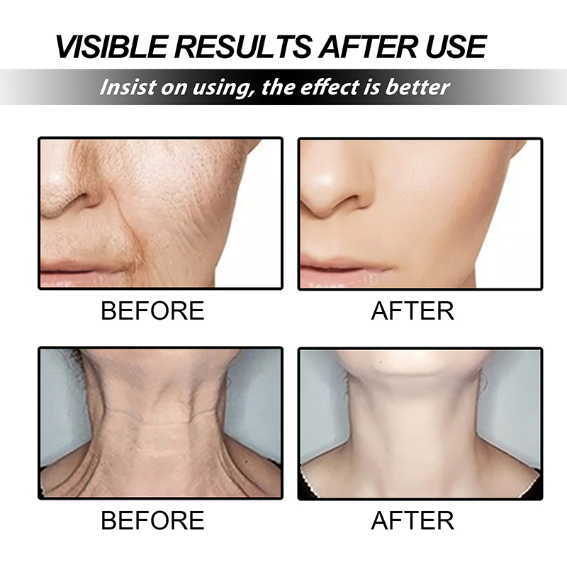 Ansiktsbehandling Naturlig Anti-rynkor Firmin Reparation Hudblekning Utspädd Ljusare Ansikte Nacke Fina linjer Hudvård_voghion.com