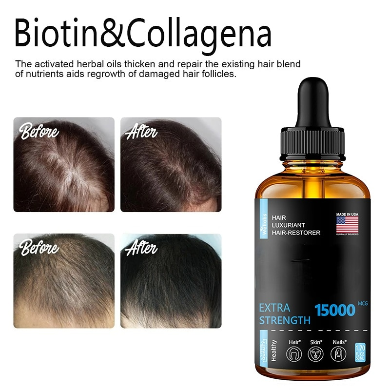 Hårtillväxt Eteriska oljor Produkter Ingefära Essens Snabb återväxt Serum Skäggtillväxtolja Håravfallsvård Skönhetsbehandling av hårbotten_voghion.com