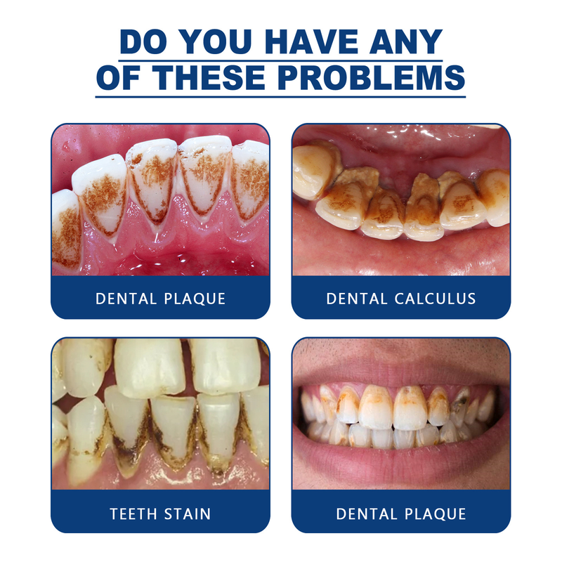 Stone Jayswing Dental Dissolving oralni sprej za čišćenje lošeg zadaha i kamenca, ostavlja miris dugotrajno i_voghion.com