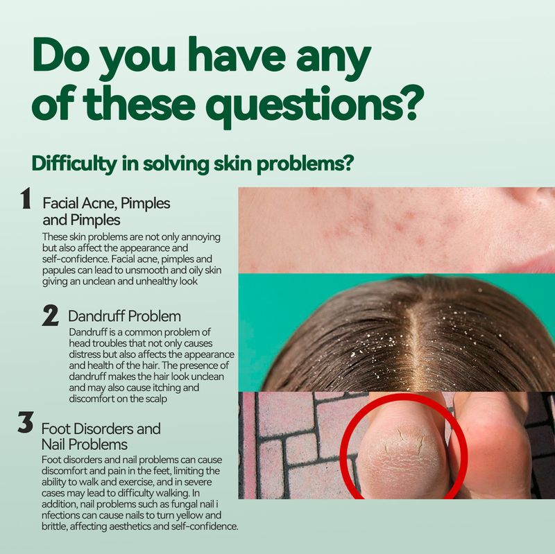 Das ätherische Öl des roten Teebaums von EELHOE reduziert Akneflecken, spendet Feuchtigkeit für die Füße, verhindert Risse und bietet mehrere_voghion.com