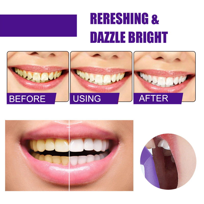 V34 Series Mousse Tooth Whitening Clean Fresh Breath Toothpaste White Teeth Cleaning Product_voghion.com
