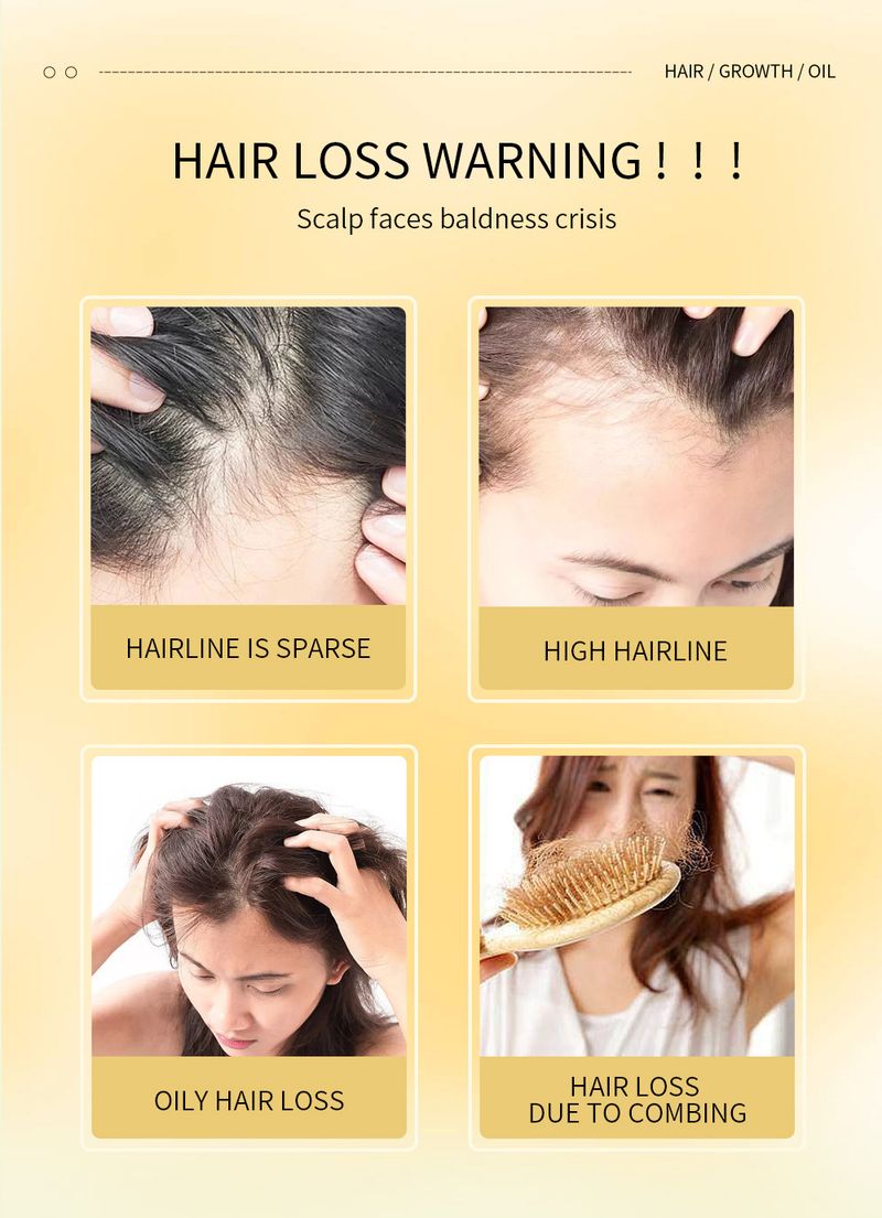 Vlasové výživné sérum – vlasový olej pro péči o pokožku hlavy, proti vypadávání vlasů a ošetření pro opětovný růst vlasů_voghion.com