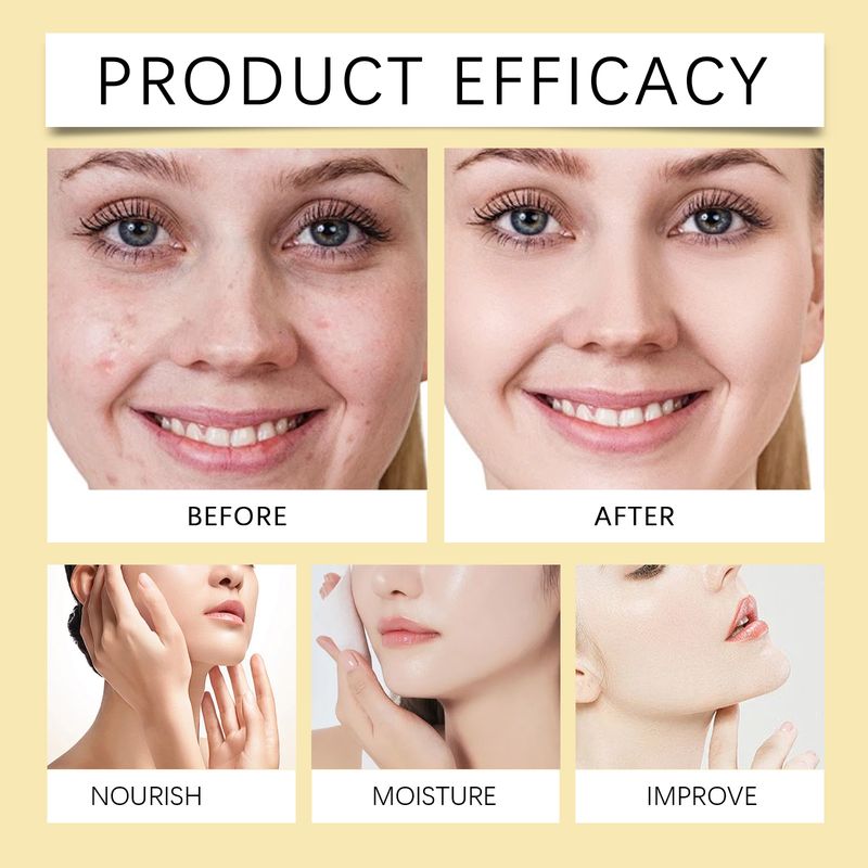 OUHOE Hyaluronic Acid Facial Essence Gentle Moisturizing Moisturizing Gloss Sensitive Dry Mild Essence_voghion.com