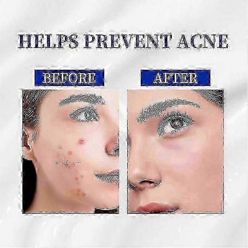 A-313 Vitamin A Retinol Cream A~313 Retinol Anti-Aging Cream For Face, Reduces Pores & Wrinkles, Treats Acne & Dark Spots_voghion.com