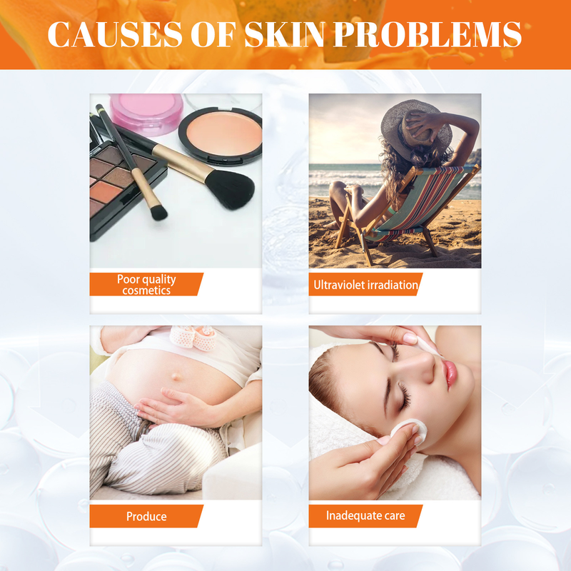 Papaya Day Night Cream Fjern mørke pletter Melanin Sorte Prikker Melasma Remover Anti Pigmentation Brighten Whitening Freckle Cream_voghion.com