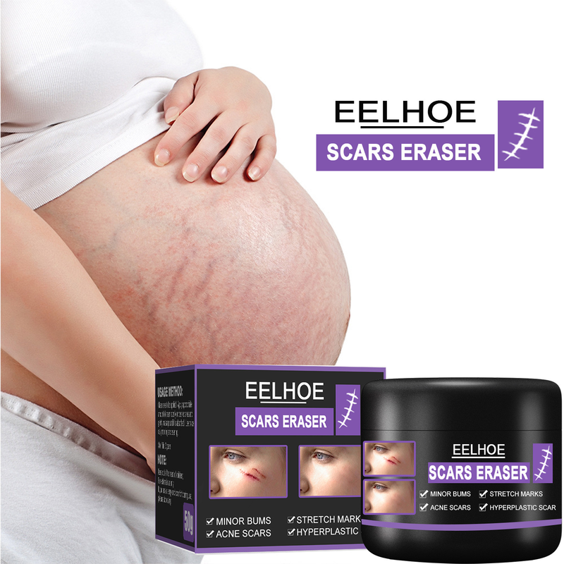 EELHOE Narbe zur Aufhellung postoperativer Narben, zur Glättung der Haut, zur Reparatur und Befeuchtung der Hautpflegecreme_voghion.com