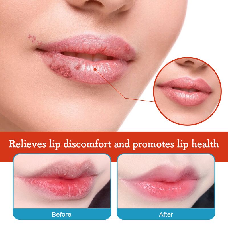 Lip Repair Cream Moisturizes moisturizes the lips, removes dead skin, prevents dryness, and lightens lip lines_voghion.com