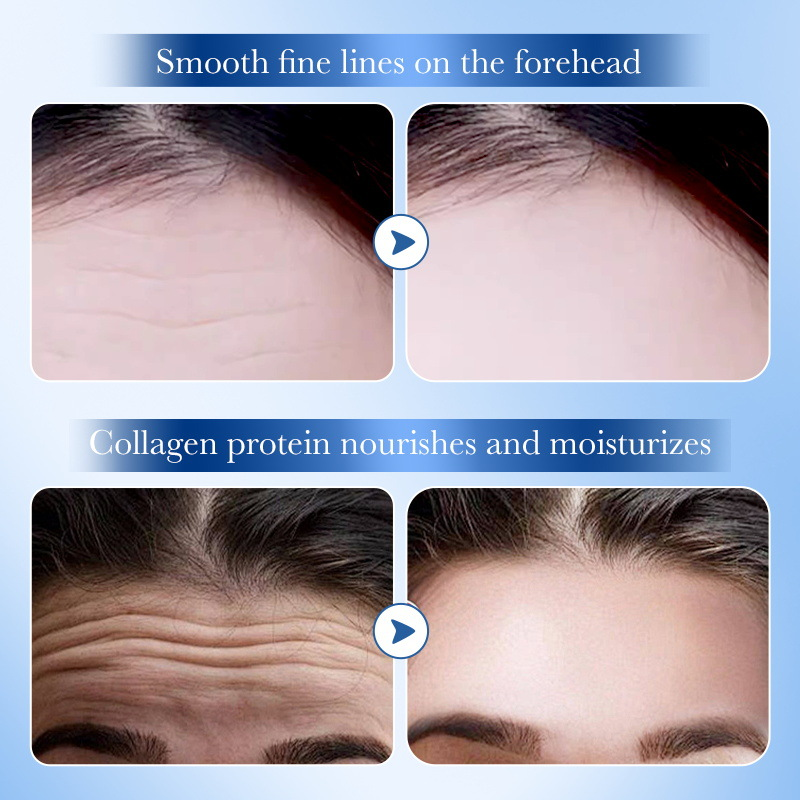 SADOER Hyaluronic Acid Collagen Firming Improve Forehead Lines Gel Patch_voghion.com