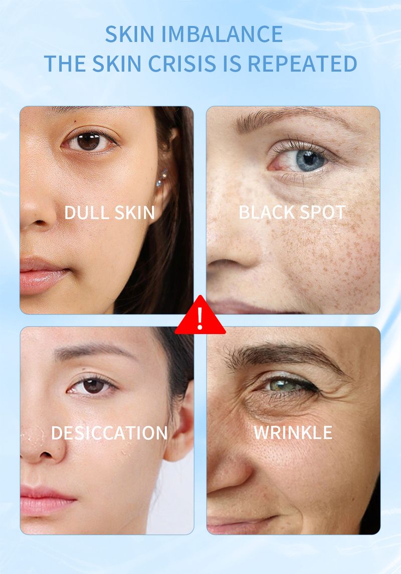 Niacinamide Serum - Vitamin B3 Hydrating, Moisturizing, And Brightening Facial Essence_voghion.com