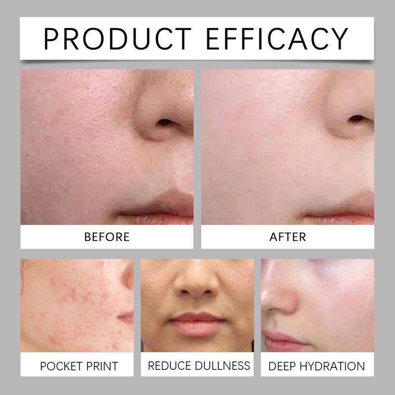 Viareline Witch Hazel Eucalyptus Moisturizing Toner Deep Moisturizes Long-Lasting Moisturizing Gently Soothing Hydrating_voghion.com