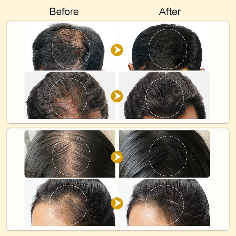 IBeaLee Black Sesame Growth Liquid for Root Strengthening, Moisturizing, Repairing, Improving Anti Loss, Firming, and_voghion.com