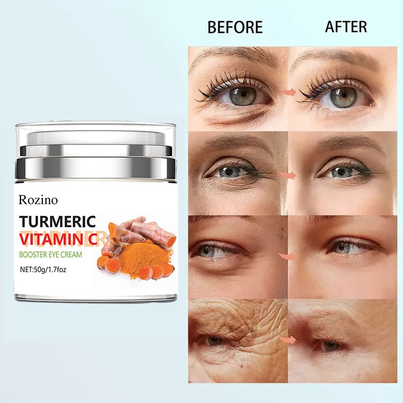 Turmeric cream reduces fine lines and dark circles around eyes, removes eye bags, fights wrinkles, brightens skin,_voghion.com