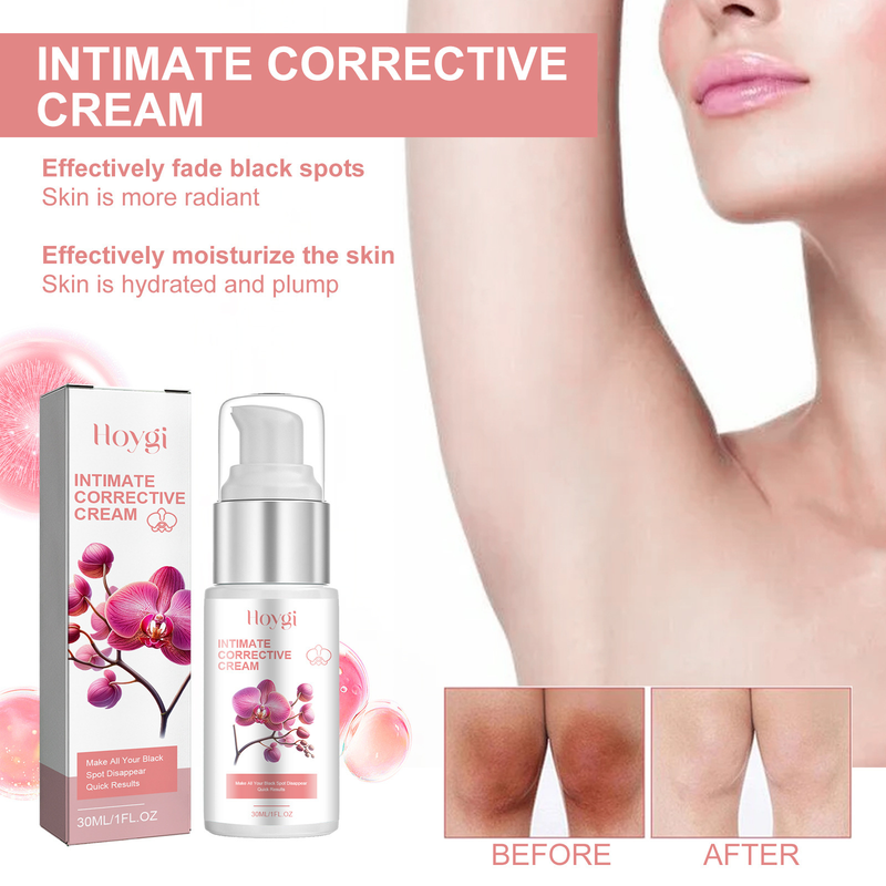 Hoygi Black Spot Care Cream Fukter huden, lysner opp hudens tone, reduserer mørke flekker og gjør huden glatt og strålende._voghion.com