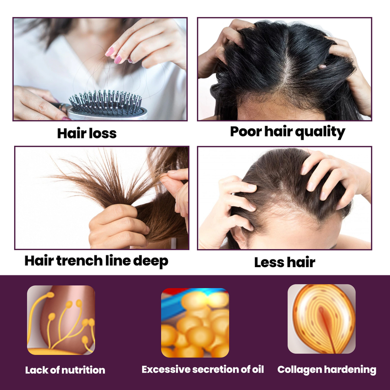 EELHOE foam growth care, strong anti dropping, stimulating follicle, long hair, nutrition and hair fixation_voghion.com
