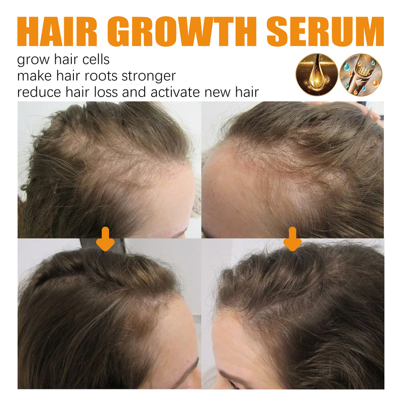 Biotyna wzrostu w sprayu Tough Massage Scalp Gęsty ujędrniający płyn zapobiegający wypadaniu włosów_voghion.com