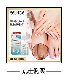 Grey Nail Beautiful Repair Thickening, Brightening, Soft Nail , Foot Care , Grey Nail Enhancement_voghion.com