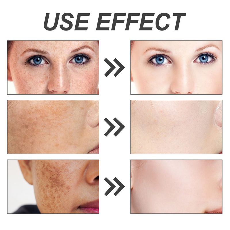OUHOE deterge delicatamente la pelle del viso, riduce la pigmentazione, ravviva il tono, idrata la pelle con il sapone koji_voghion.com