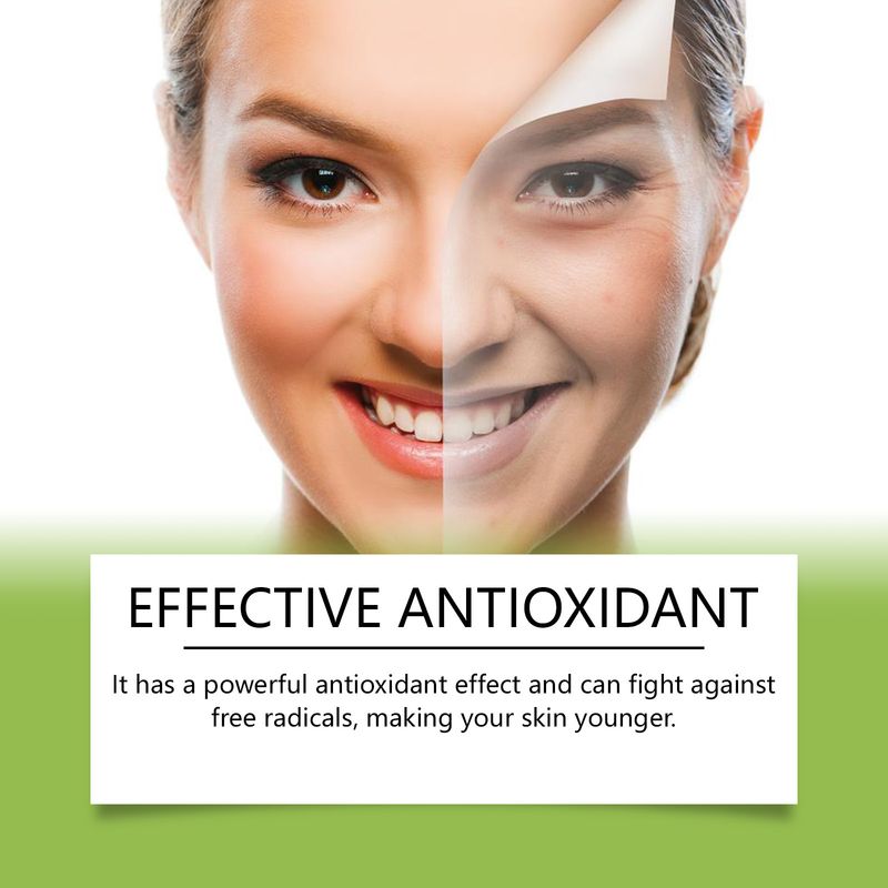 OUHOE Aloe Moisturizing Care Gel Moisturizing, Moisturizing, Caring For Skin, Improving Dullness, Multi Effect Care Gel_voghion.com