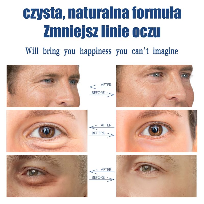 East Moon Men's Retinol Eye Cream, Firming And Lightening Eye Bags, Moisturizing And Repairing Eye Cream_voghion.com