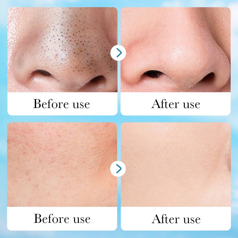 All English SADOER Aloe Vera Pore Clear Solid Facial Mask Cleaning Facial Mud Mask_voghion.com