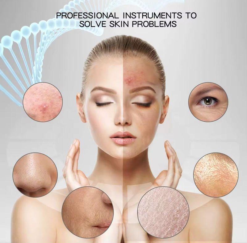 Épurateur de peau à ultrasons, élimine les points noirs, nettoie le visage en profondeur et nettoie les pores_voghion.com