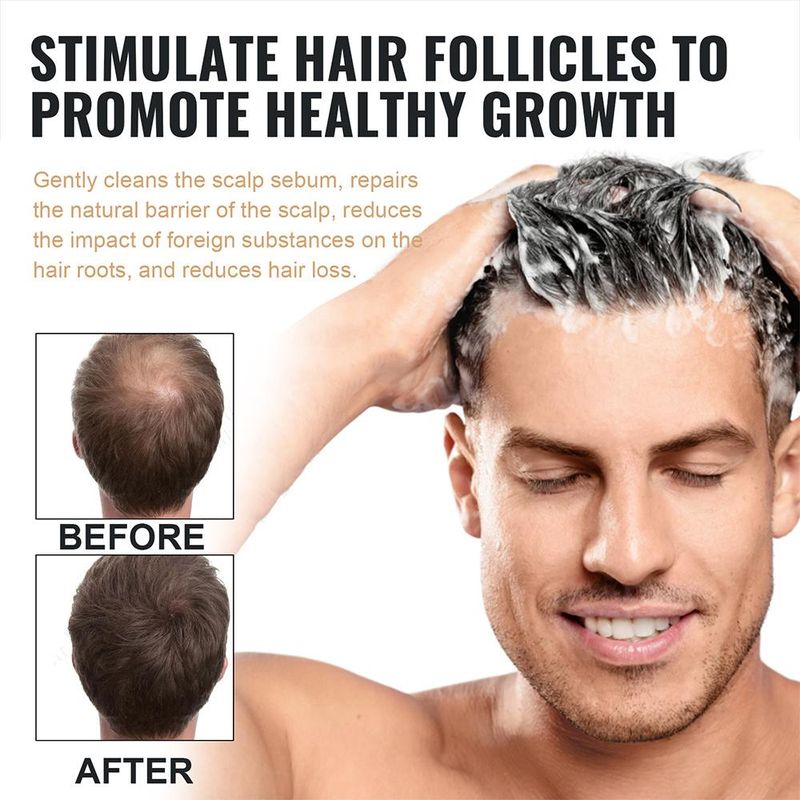 2PCS Anti-Haarausfall-Shampoo, Verdickungsshampoo, Wurzelaktivator-Shampoo, nährendes Haarwachstums-Shampoo für dünner werdendes Haar und Haarausfall_voghion.com