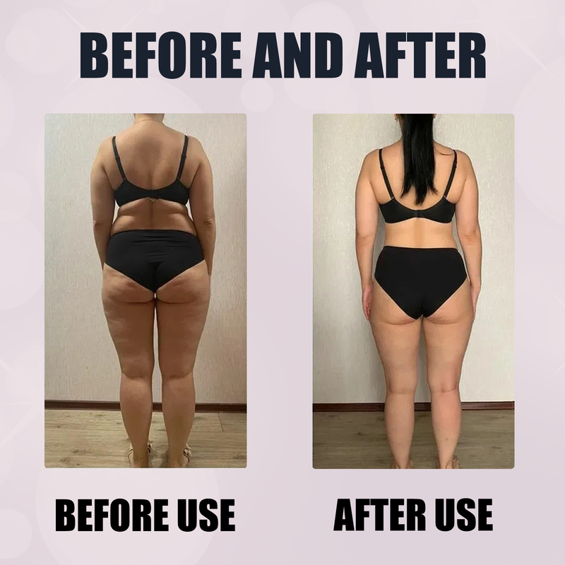 herbal slimming Beautiful navel patch for shaping the body, slimming the large belly, tightening the thigh muscles, an_voghion.com