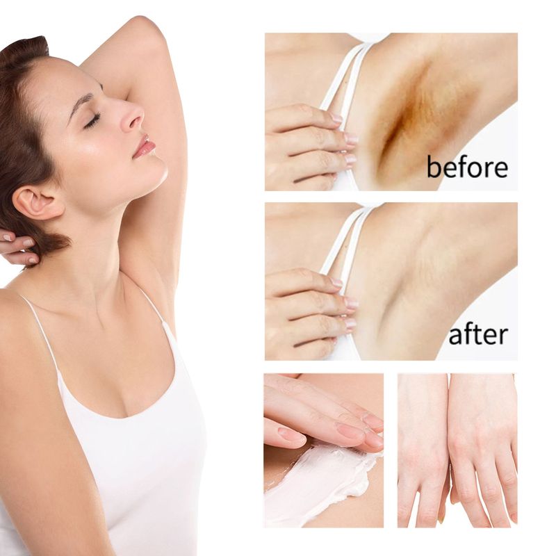 Niacinamide Whitening Cream reduces dullness, underarm, elbow joint blackness, even skin tone, and_voghion.com
