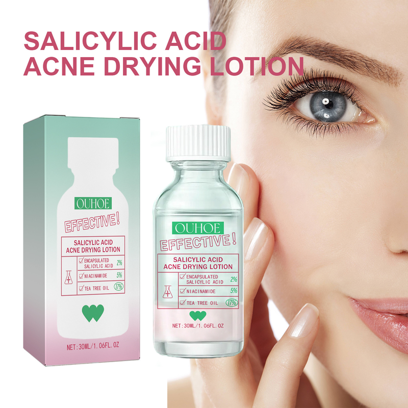 Salicylic Acid Acne Removal Serum Pimples Treatment Anti Whiteheads Oil Control Shrinking Pores Moisturizing Cleansing Skin Care Face care_voghion.com
