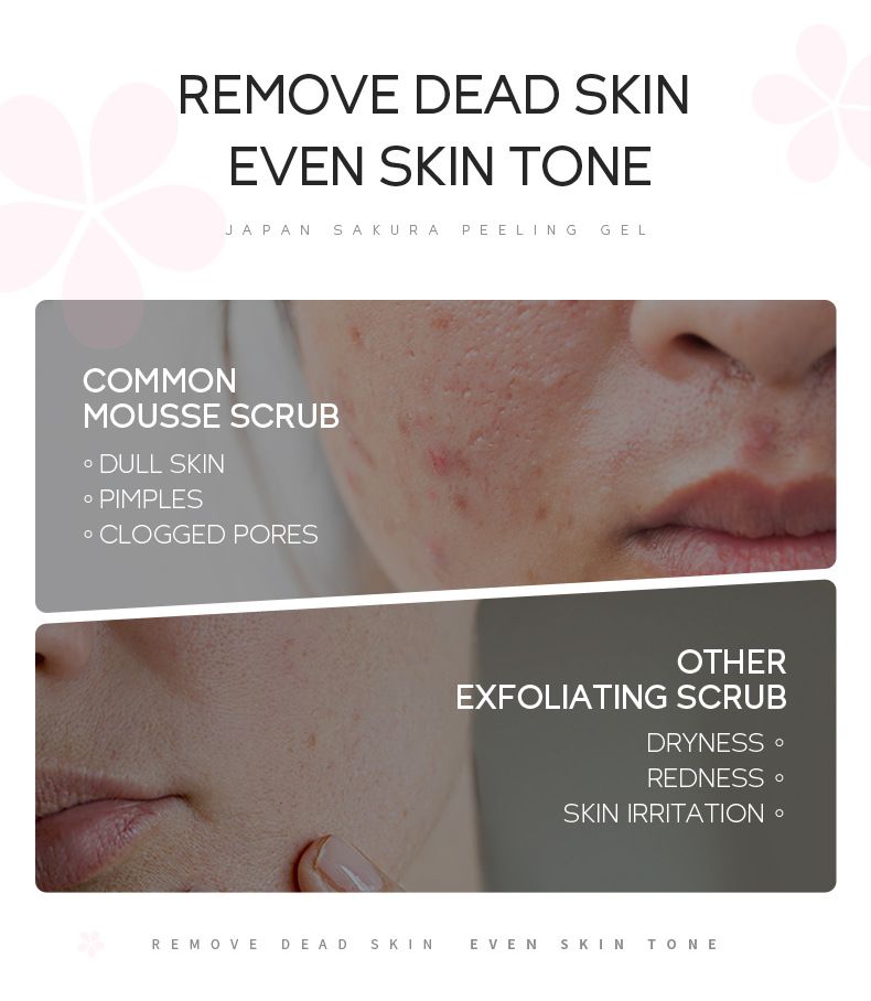Facial Scrubs & Polishes Cherry Keratin 100g Clean Pores Moisturizing_voghion.com